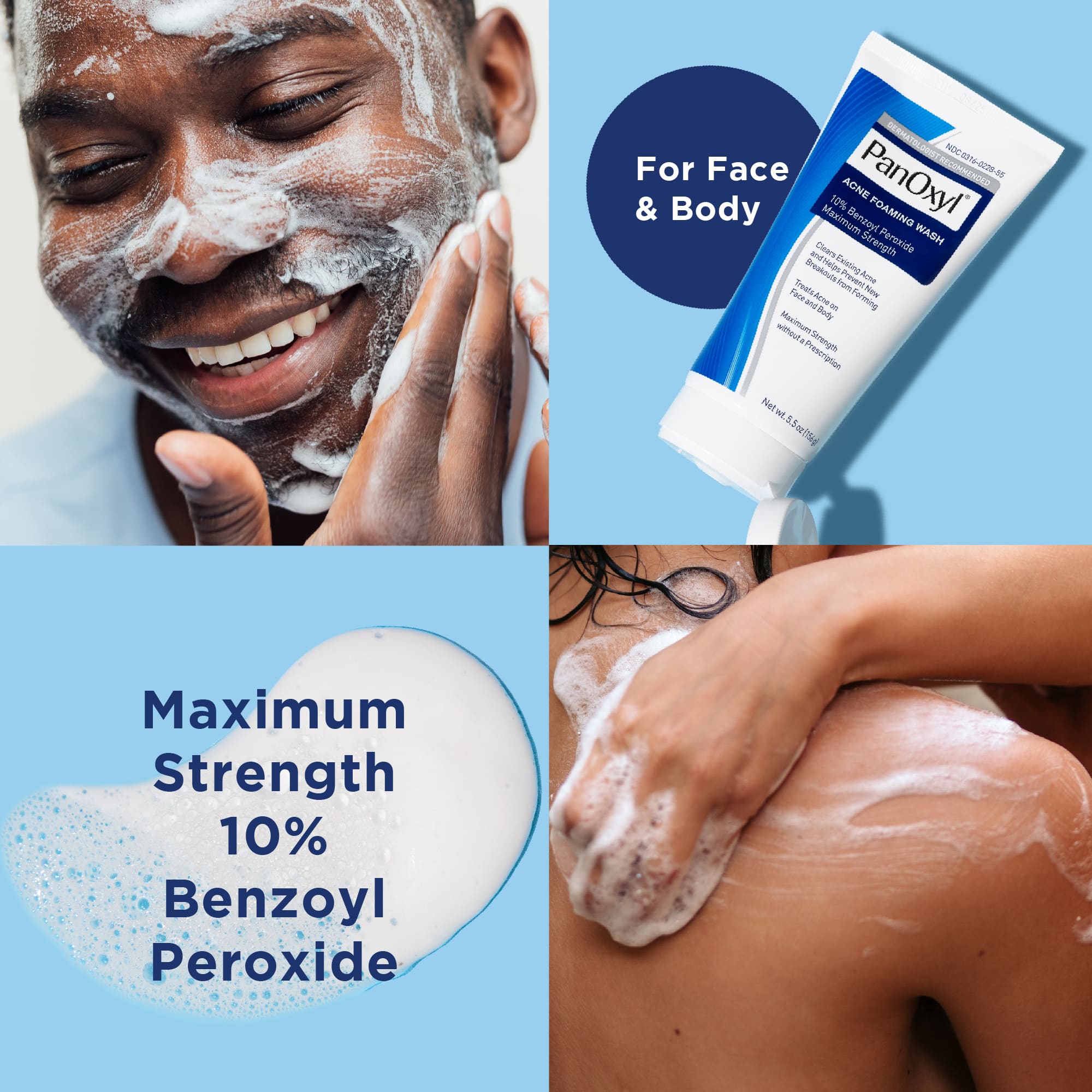 Panoxyl Foaming Acne Wash Maximum Strength 10% Benzoyl Peroxide